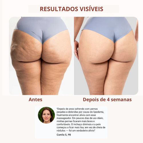 DrenaRoller Massageador Linfático para Lipedema e Celulite